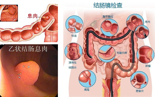 萎縮性胃炎真的“很嚇人”？看完這“七個事實”你就明白了